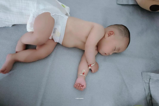 固原宝宝褶皱处擦粉还是油